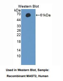 https://msimg.bioon.com/bionline/goods-no-pic.png