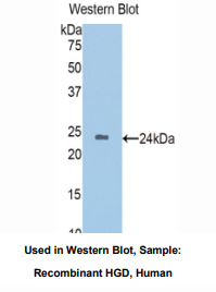 https://msimg.bioon.com/bionline/goods-no-pic.png