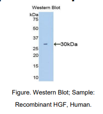 https://msimg.bioon.com/bionline/goods-no-pic.png