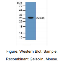 https://msimg.bioon.com/bionline/goods-no-pic.png