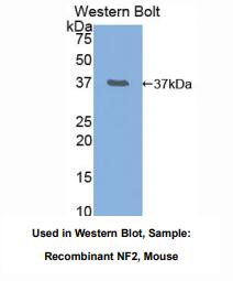 https://msimg.bioon.com/bionline/goods-no-pic.png