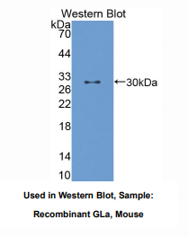 https://msimg.bioon.com/bionline/goods-no-pic.png