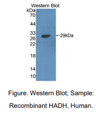 https://msimg.bioon.com/bionline/goods-no-pic.png