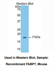 https://msimg.bioon.com/bionline/goods-no-pic.png