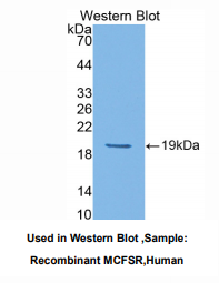 https://msimg.bioon.com/bionline/goods-no-pic.png