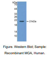 https://msimg.bioon.com/bionline/goods-no-pic.png