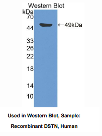 https://msimg.bioon.com/bionline/goods-no-pic.png