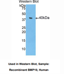 https://msimg.bioon.com/bionline/goods-no-pic.png