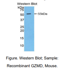 https://msimg.bioon.com/bionline/goods-no-pic.png