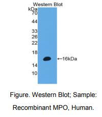 https://msimg.bioon.com/bionline/goods-no-pic.png