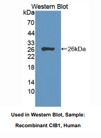 https://msimg.bioon.com/bionline/goods-no-pic.png