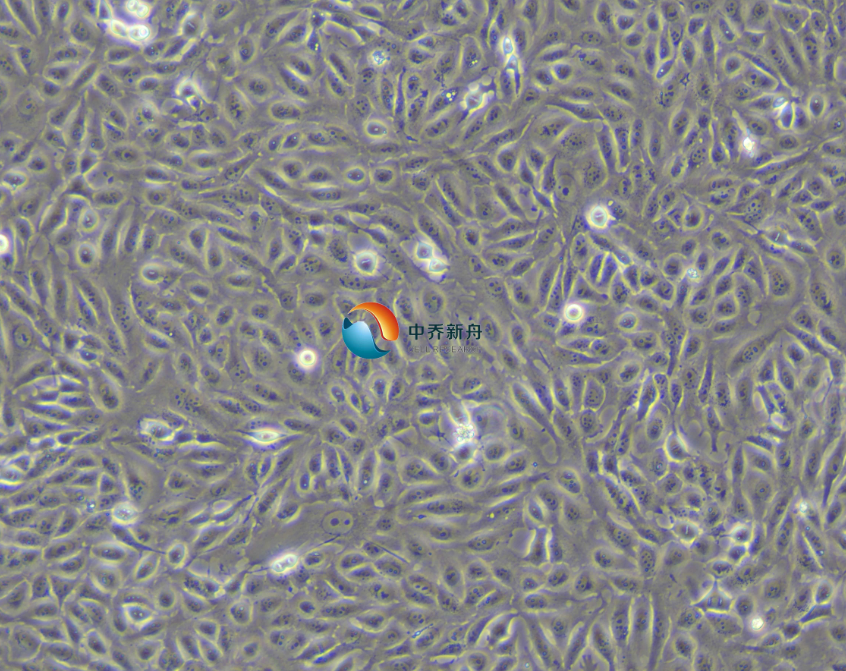 https://img.medsci.cn/8eee53bbc4cb7a98de615e72115896bc4e27fda5cbb764dbd67d9d641c2bb46a.png