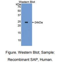 https://msimg.bioon.com/bionline/goods-no-pic.png