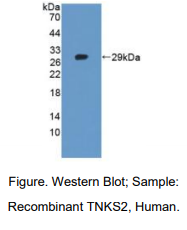 https://msimg.bioon.com/bionline/goods-no-pic.png