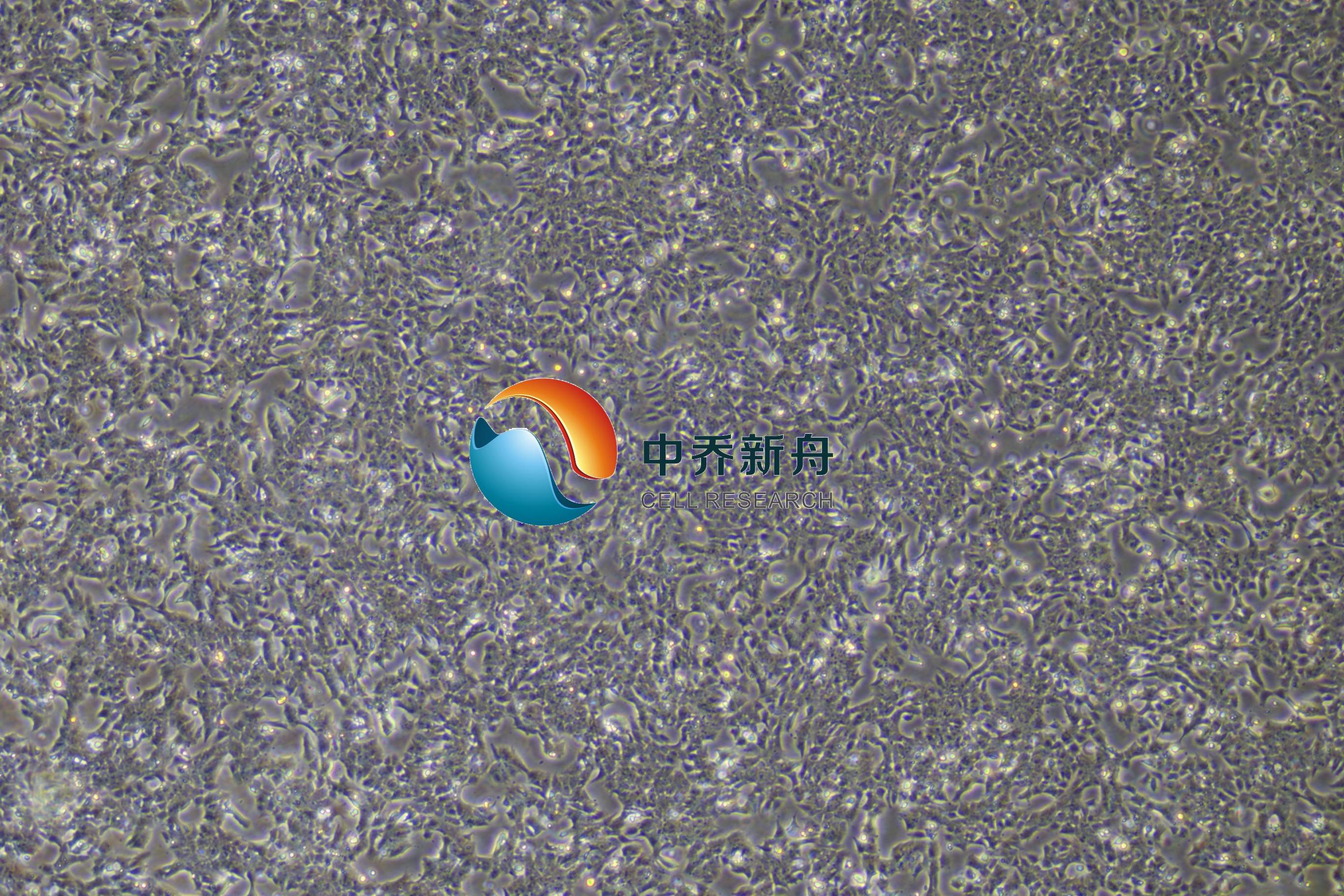 GT1-1小鼠垂体瘤细胞