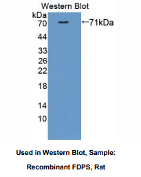 https://msimg.bioon.com/bionline/goods-no-pic.png