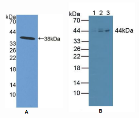 人核因子κB抑制因子β(IkBb)多克隆抗体
