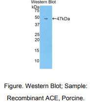 https://msimg.bioon.com/bionline/goods-no-pic.png