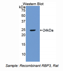 大鼠视黄醇结合蛋白3(RBP3)多克隆抗体