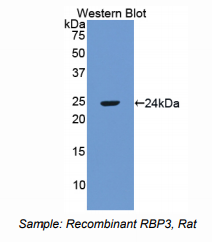 https://msimg.bioon.com/bionline/goods-no-pic.png