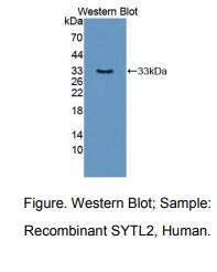 https://msimg.bioon.com/bionline/goods-no-pic.png