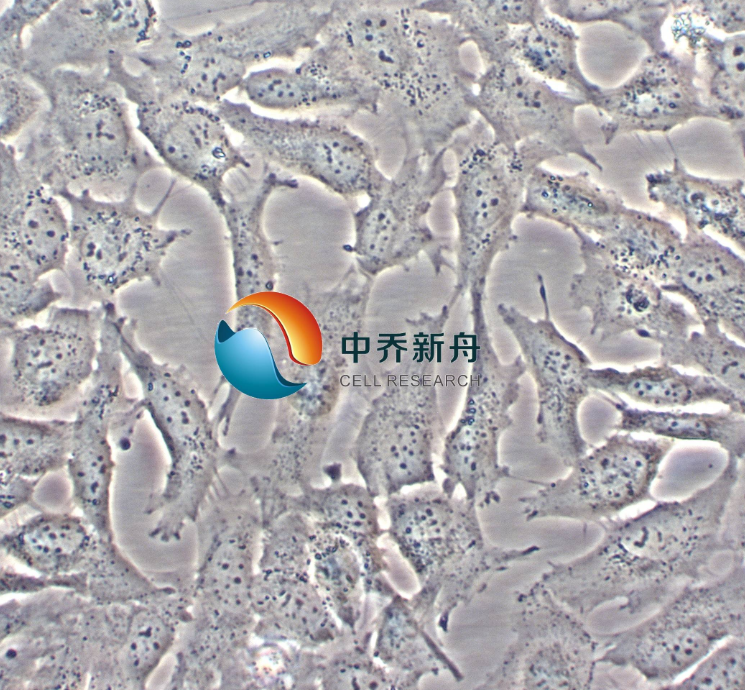 人甲状腺癌细胞KHM-5M