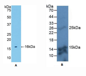 https://msimg.bioon.com/bionline/goods-no-pic.png