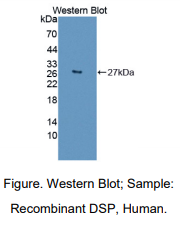 https://msimg.bioon.com/bionline/goods-no-pic.png