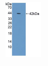 人防御素α1B(DEFa1B)多克隆抗体