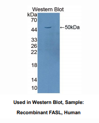人凋亡相关因子配体(FASL)多克隆抗体