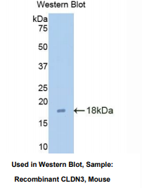 https://msimg.bioon.com/bionline/goods-no-pic.png