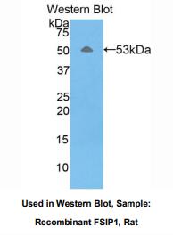 大鼠纤维鞘相互作用蛋白1(FSIP1)多克隆抗体