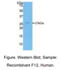 https://msimg.bioon.com/bionline/goods-no-pic.png