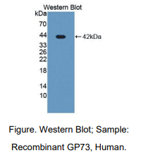 人高尔基磷酸化蛋白2(GOLPH2)多克隆抗体