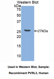 https://msimg.bioon.com/bionline/goods-no-pic.png