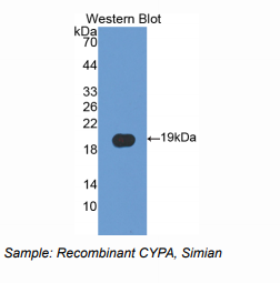 https://msimg.bioon.com/bionline/goods-no-pic.png