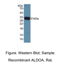 https://msimg.bioon.com/bionline/goods-no-pic.png