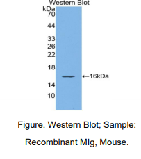 https://msimg.bioon.com/bionline/goods-no-pic.png