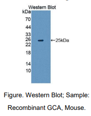 https://msimg.bioon.com/bionline/goods-no-pic.png