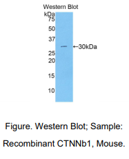 小鼠连环蛋白β1(β-catenin)多克隆抗体