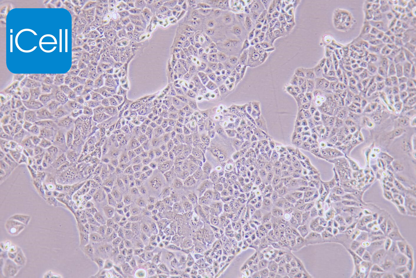 MKN-28细胞/MKN28细胞/MKN-28/MKN28/人胃癌细胞