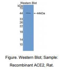 大鼠血管紧张素转化酶2(ACE2)多克隆抗体