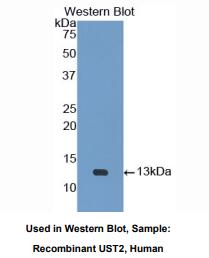 https://msimg.bioon.com/bionline/goods-no-pic.png