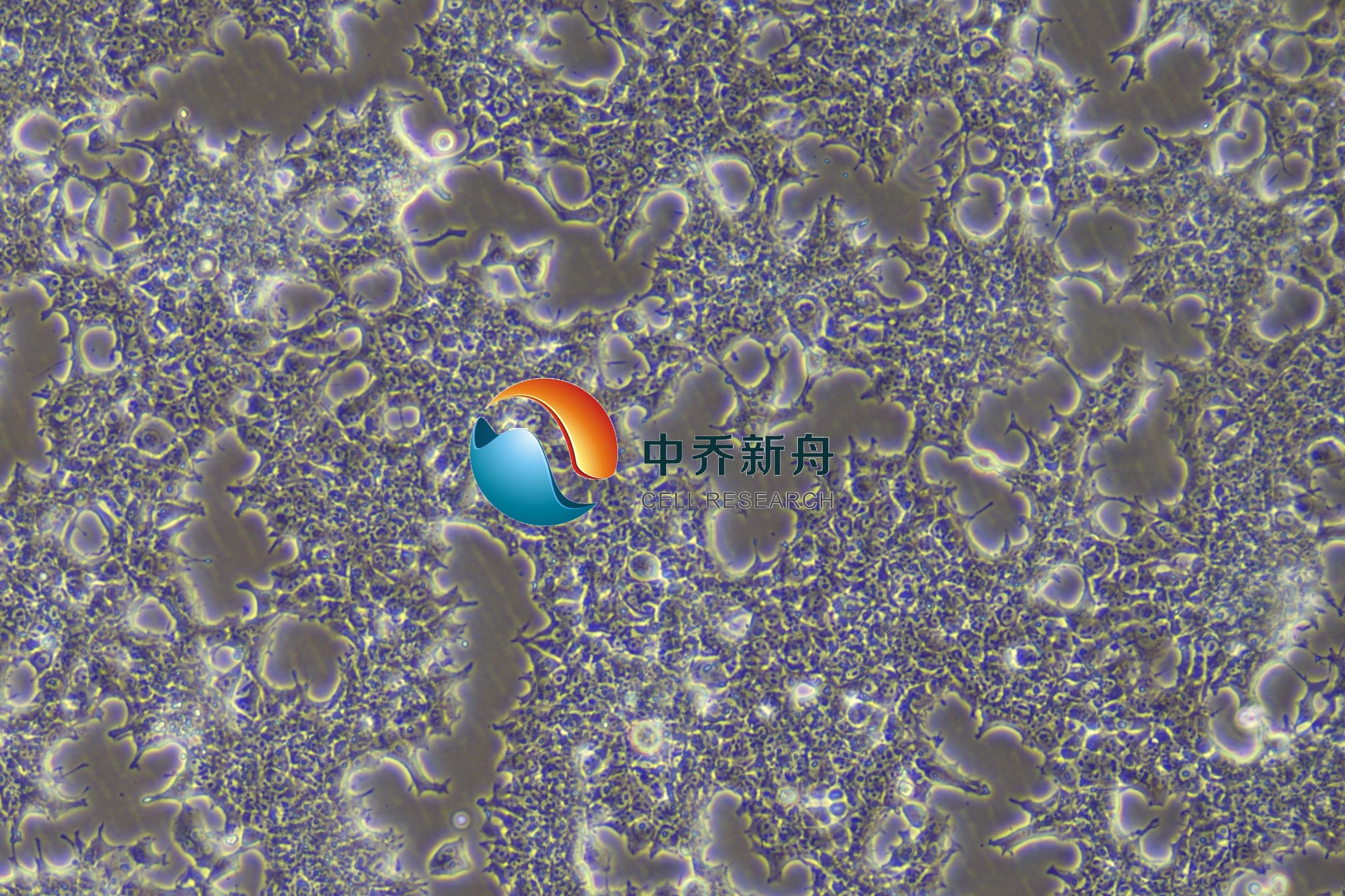 人畸胎癌细胞