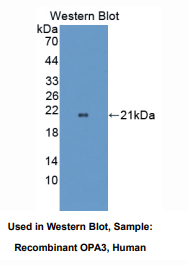 https://msimg.bioon.com/bionline/goods-no-pic.png