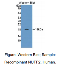 https://msimg.bioon.com/bionline/goods-no-pic.png