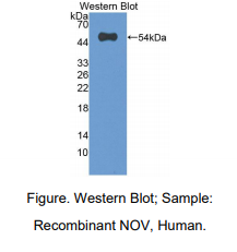 https://msimg.bioon.com/bionline/goods-no-pic.png