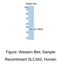 https://msimg.bioon.com/bionline/goods-no-pic.png