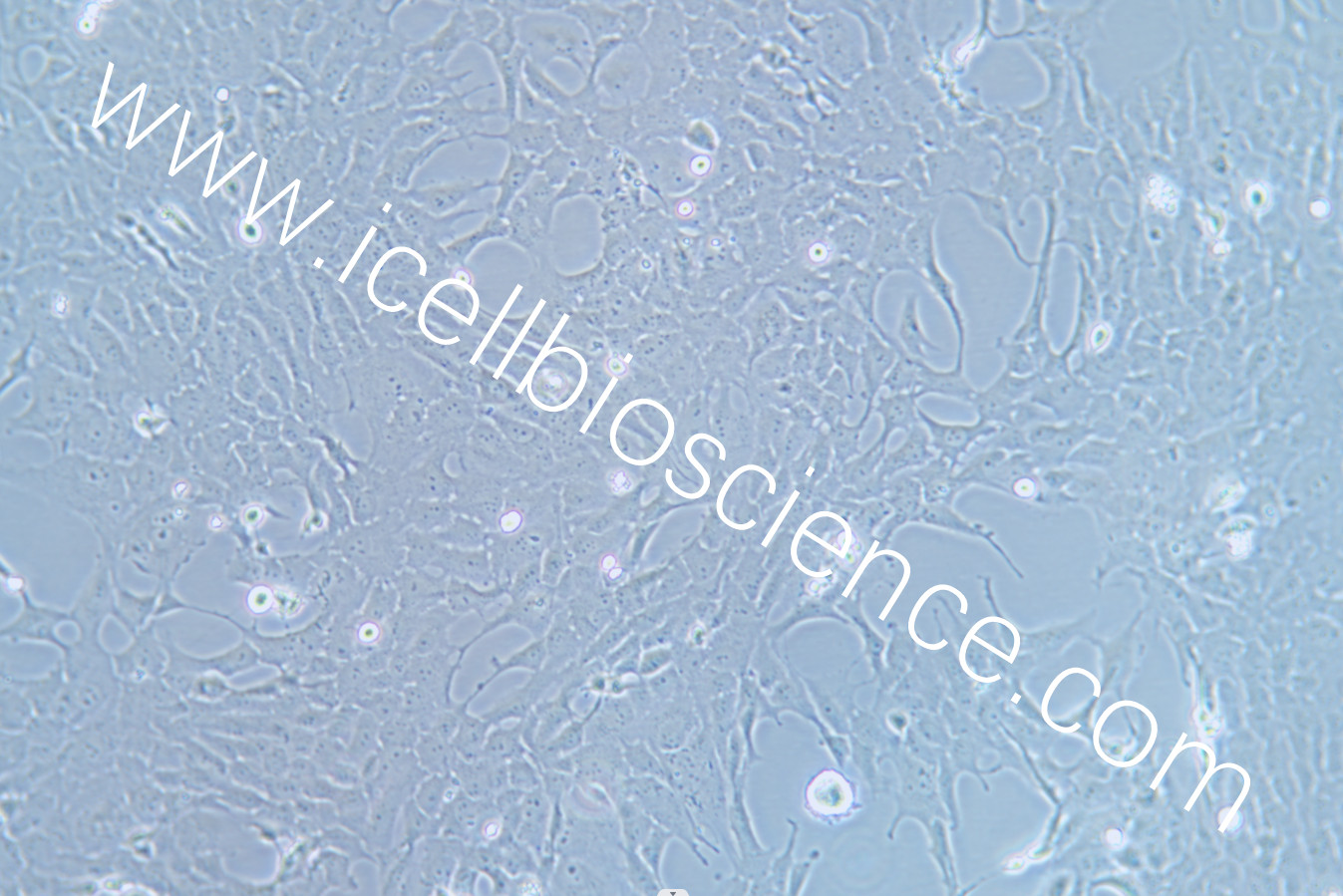 RF/6A细胞/RF6A细胞/RF-6A细胞/RF-6A/RF6A/猴脉络膜-视网膜内皮细胞