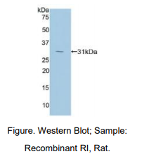 https://msimg.bioon.com/bionline/goods-no-pic.png